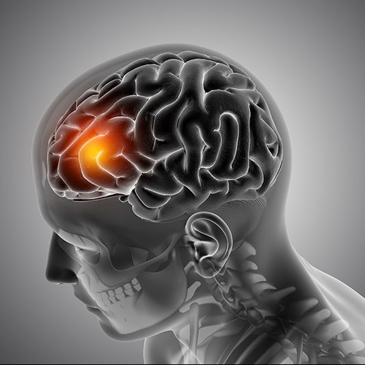 3D render of a male medical figure with front of the brain highlighted